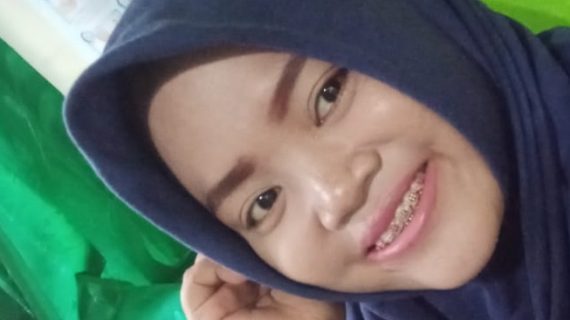 Agen Resmi Erwina Istiani